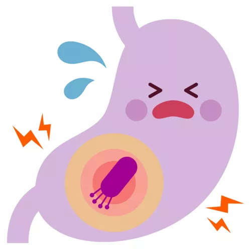 L’ulcère gastrique et duodénal